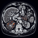 МРТ органів черевної порожнини